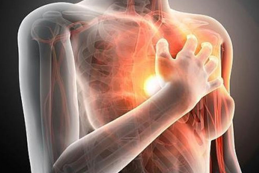 cardiopatias-mujeres