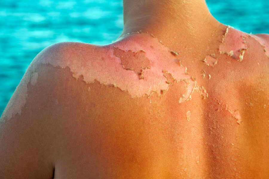 ¿Por Qué No Se Apaga El Sol? 2024