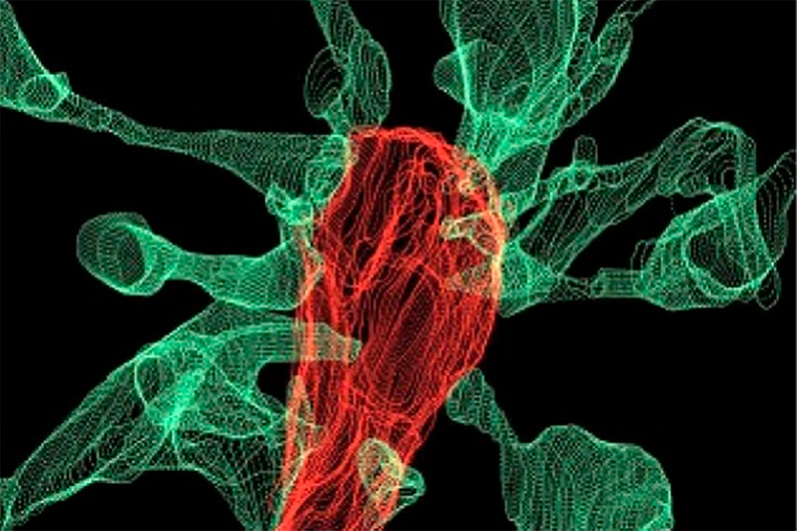 microglia